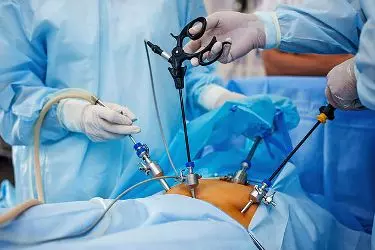 best hernia surgeon in manesar, best hospital for hernia surgery in manesar, cost of hernia surgery in manesar, best doctor for hernia treatment in manesar